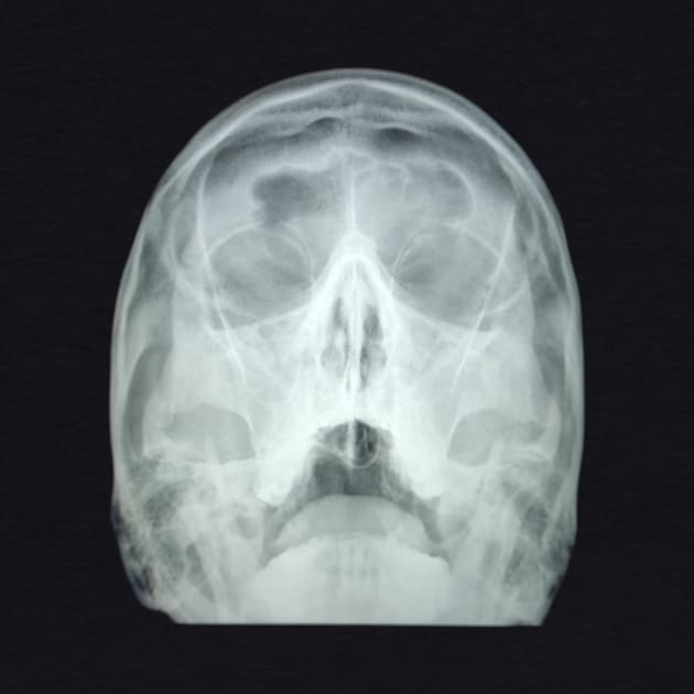 my head x-ray by Anthony88